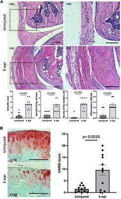 A new mouse model of post-traumatic joint injury allows to identify the contribution of Gli1+ mesenchymal progenitors in arthrofibrosis and acquired heterotopic endochondral ossification